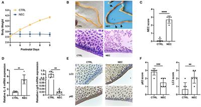 Identification and Validation of Autophagy-Related Genes in Necrotizing Enterocolitis